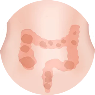 constipação intestinal dra andrea pecci proctologista em são paulo