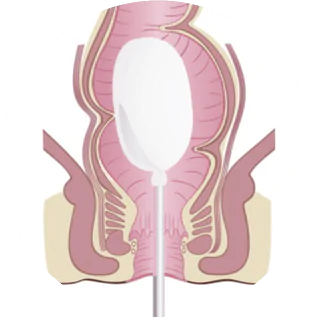 manometria anorretal dra andrea pecci proctologista em são paulo