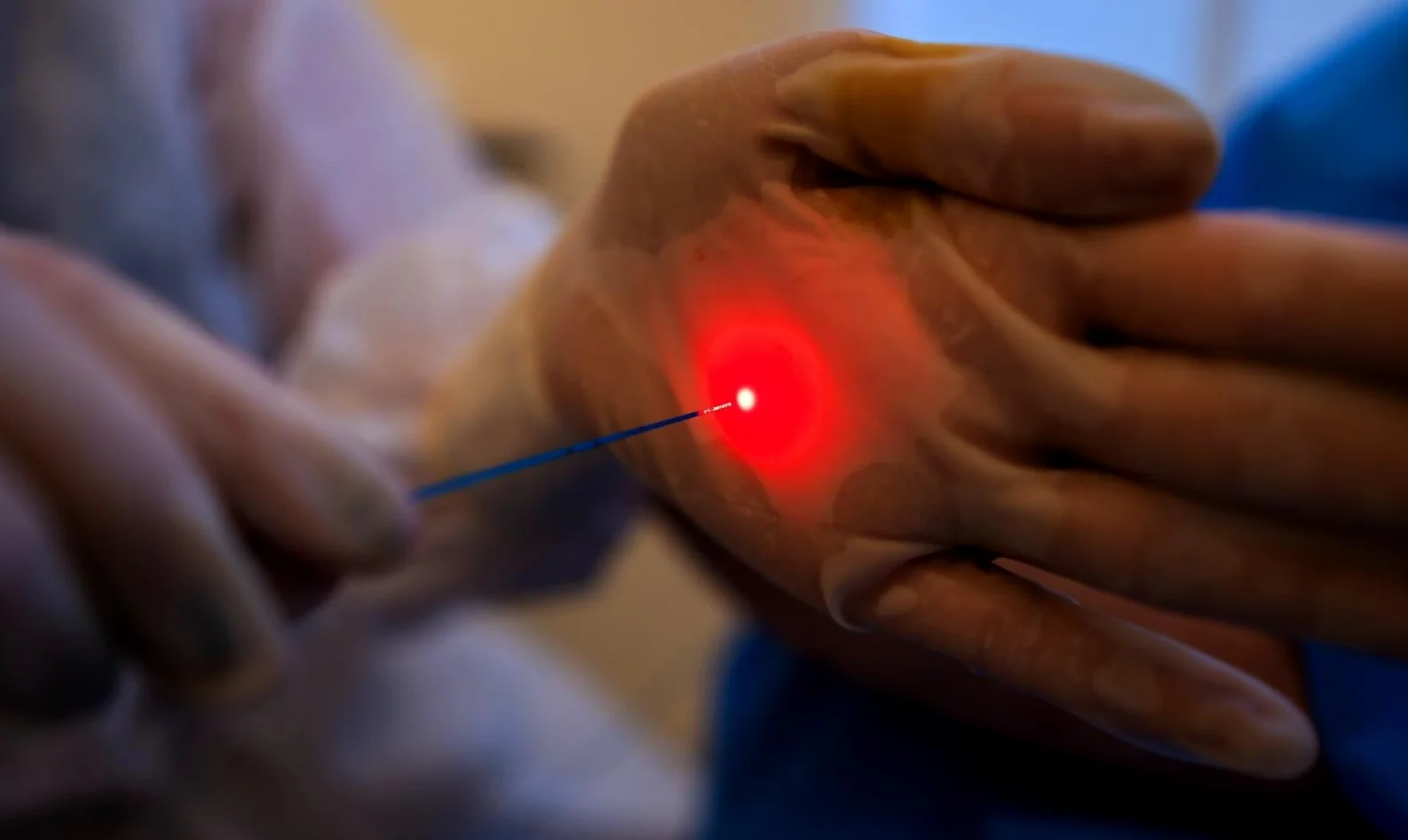 Cirurgia a Laser para Plicoma Anal 1 ciurrgia a laser de plicoma anal dra andrea pecci proctologista em são paulo