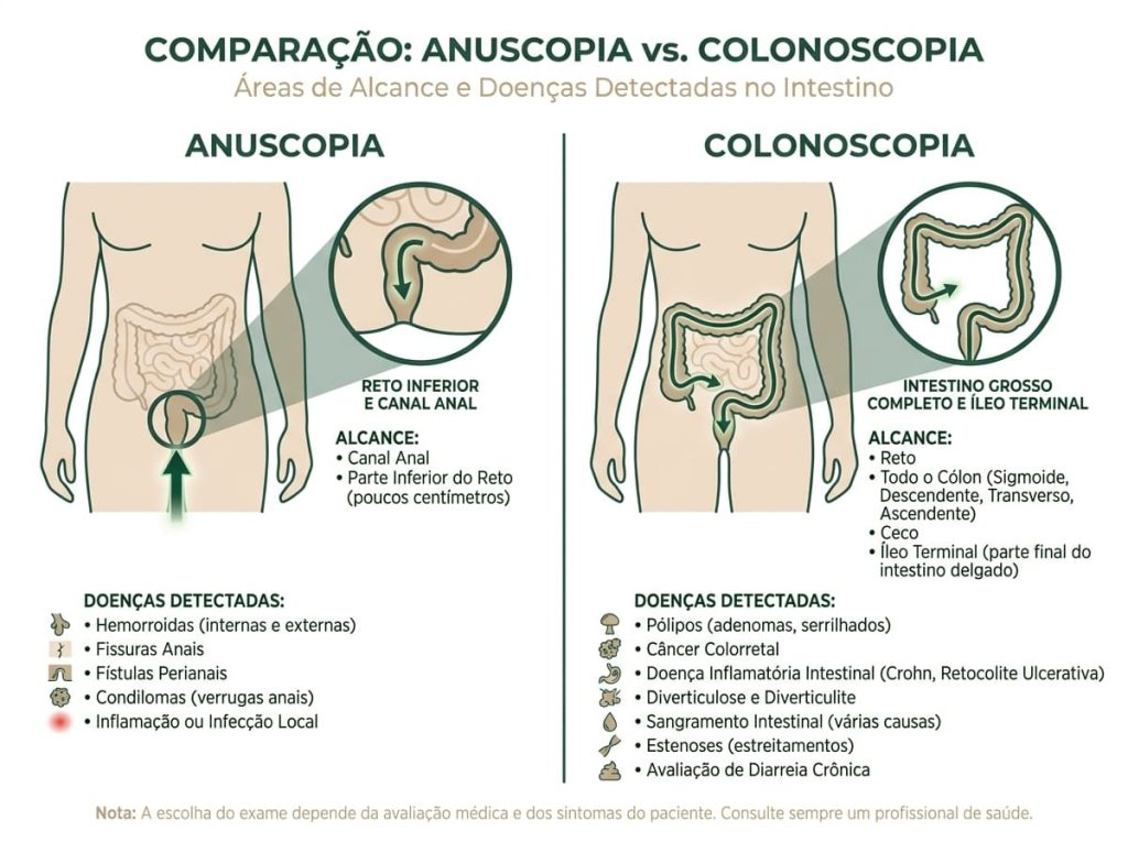 Infográfico comparativo entre anuscopia e colonoscopia — áreas do intestino avaliadas e doenças — Dra. Andrea Pecci, proctologista SP